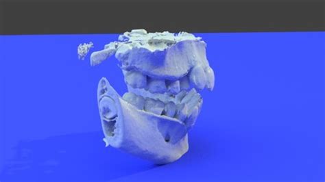nrrd to stl|dicom to stl converter.
